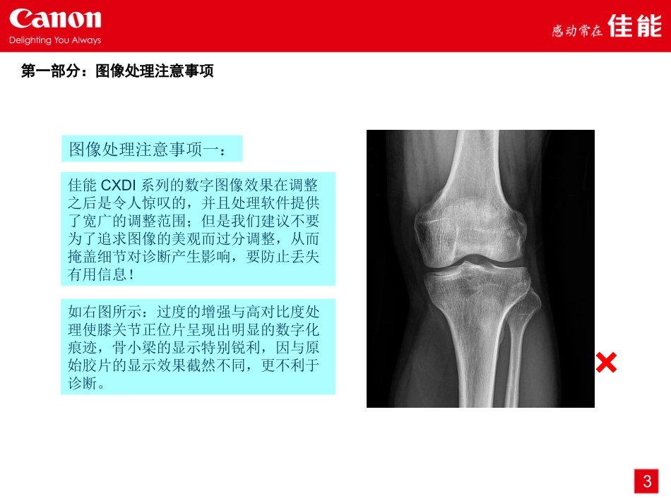 佳能CXDI数字成像系统床边机(放射科医师使用)_第3页