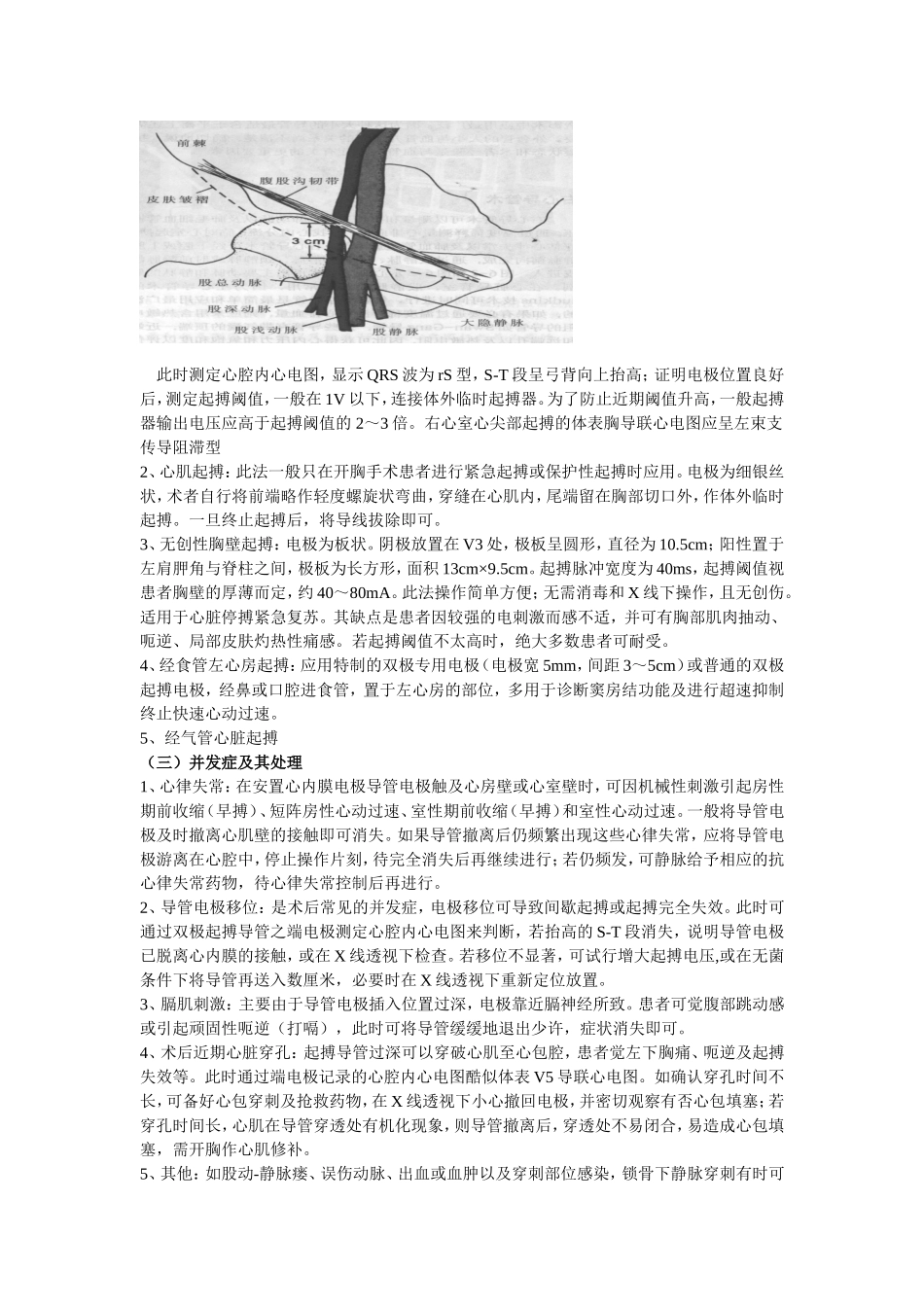 体外起搏及相关护理_第3页