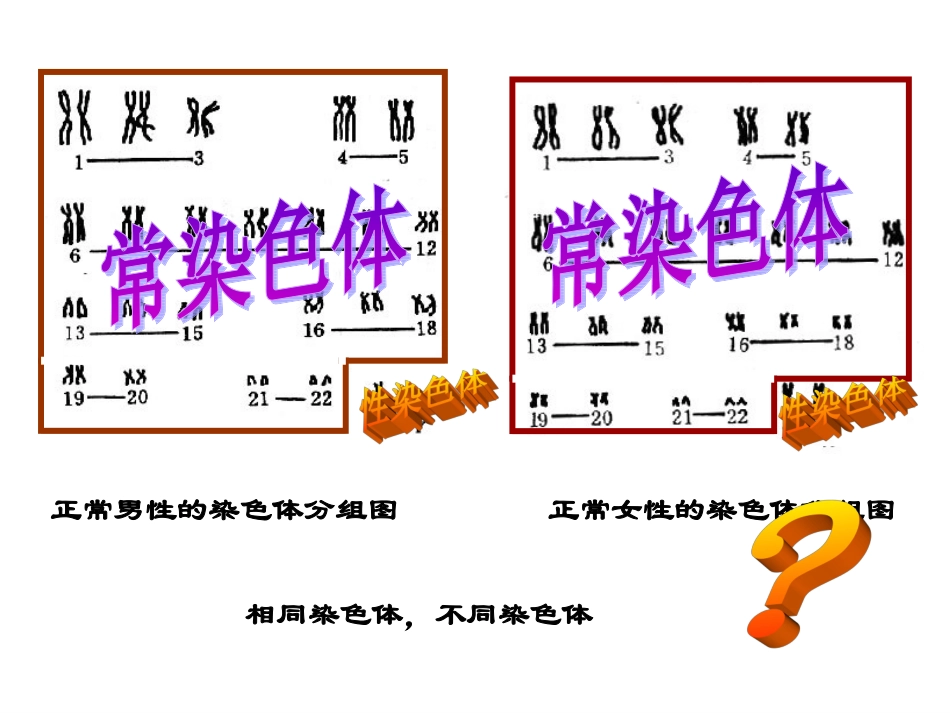 伴Y染色体遗传病外耳道多毛症2_第3页