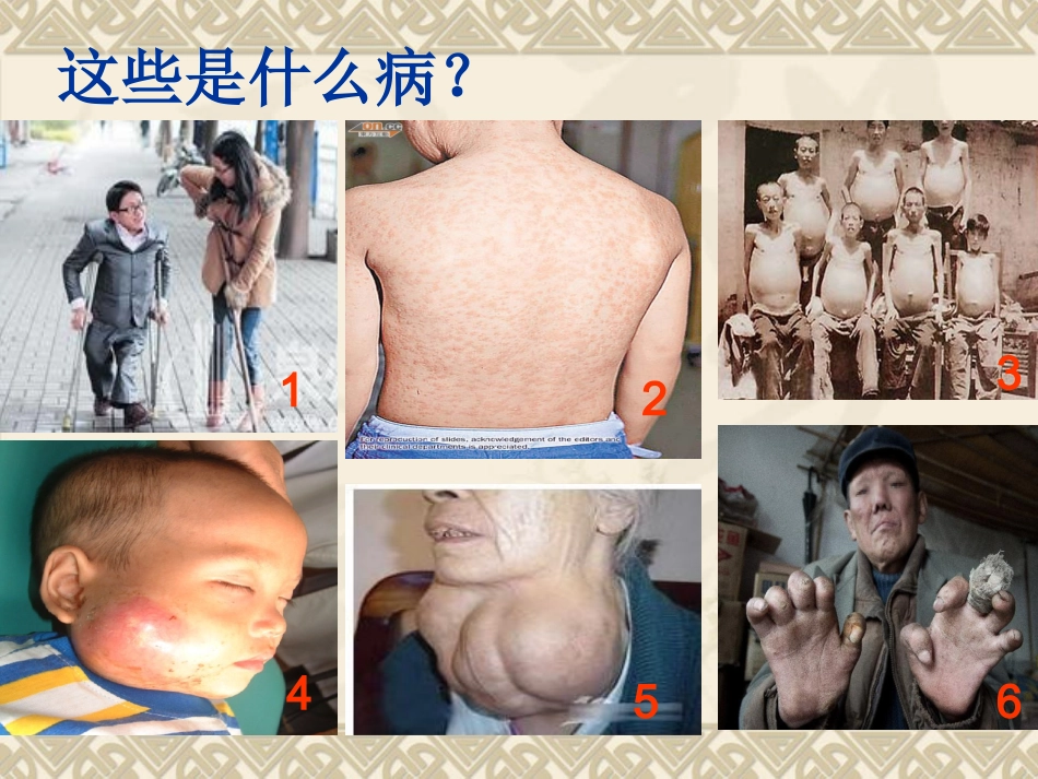 传染病知识简介_第2页