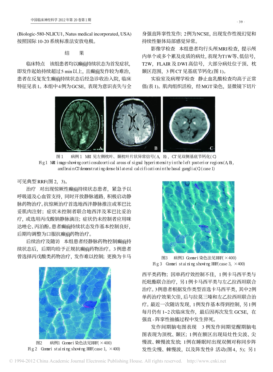 以癫_持续状态起病的线粒体脑肌病合并乳酸血症与脑卒中样发作的临床特征分析_第3页