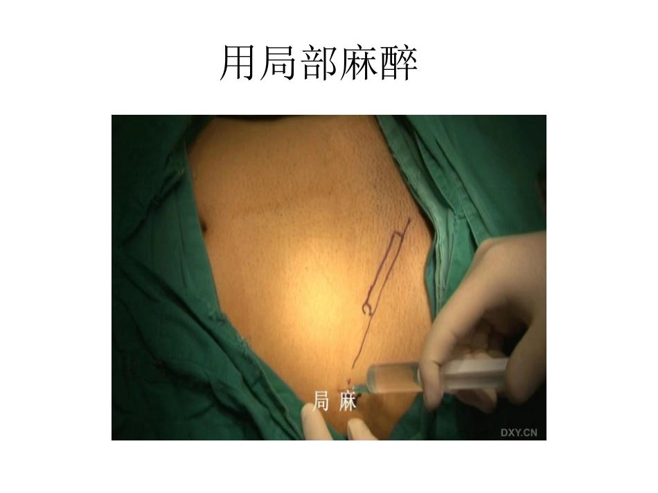 从皮肤到骼耻束_第3页