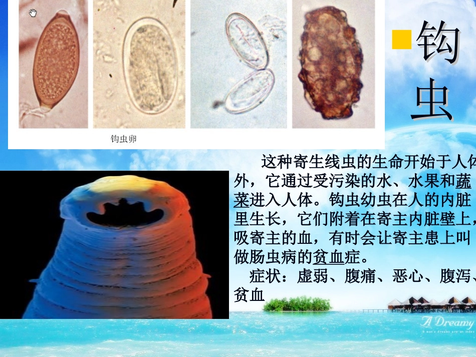 人体十大寄生虫概述_第3页