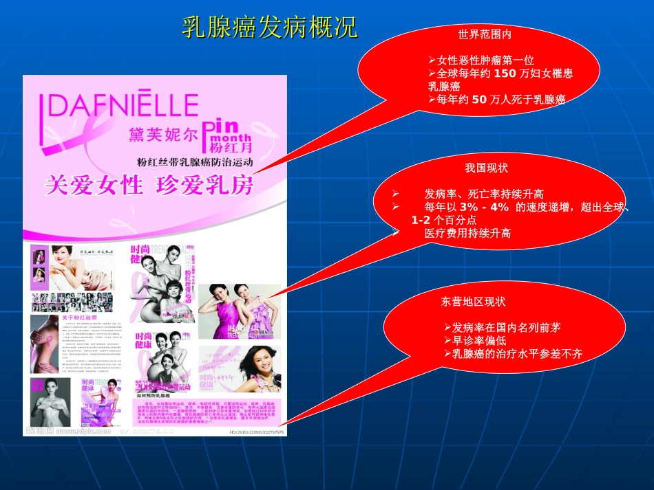 乳腺癌筛查讲座——陈登攀_第2页