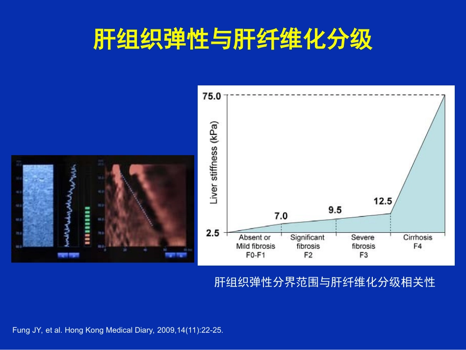 乙肝肝硬化并发症的处理_第3页
