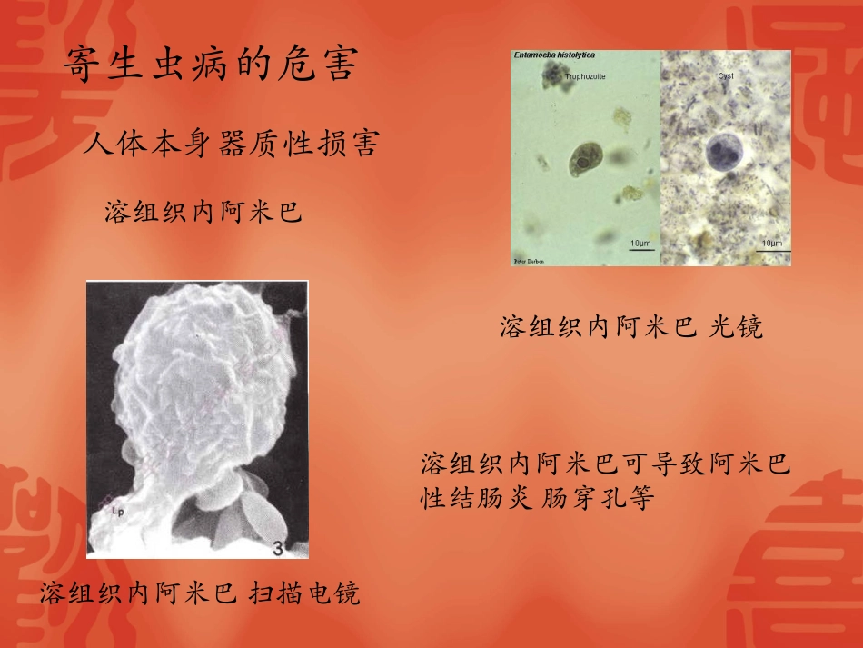 为何民众对寄生虫病的重视程度不够_第3页