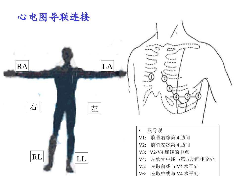 临床心电图教学liu_第3页