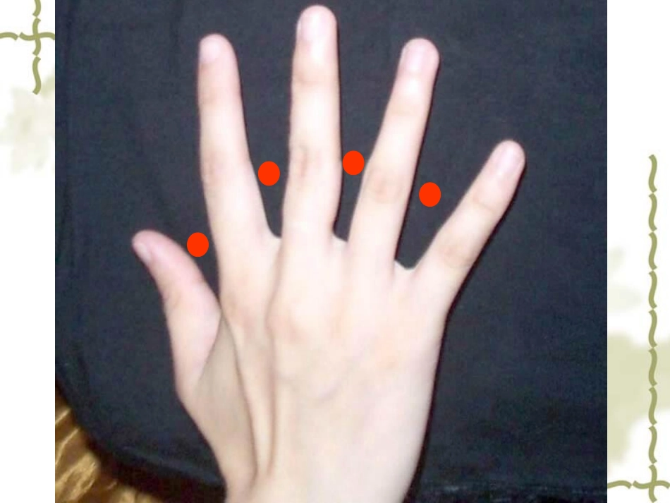 植树问题课件(1)_第2页