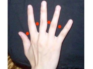 罗善琼第八单元植树问题8