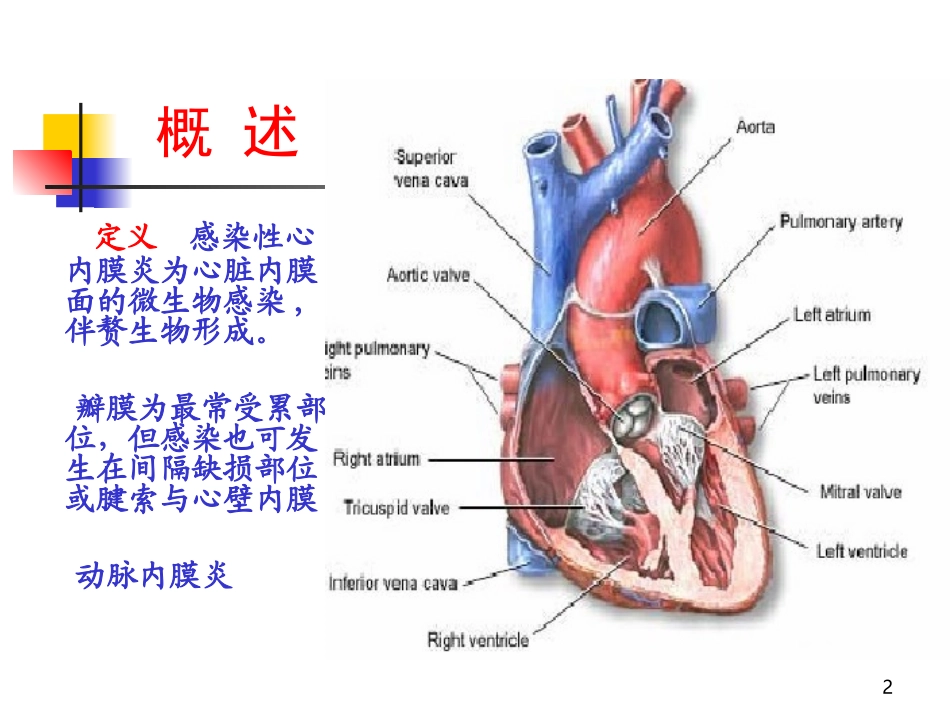 感染性心内膜炎(2学时)_第2页