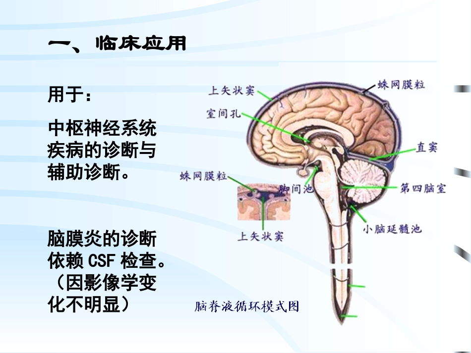 CSF脑脊液检查_第2页