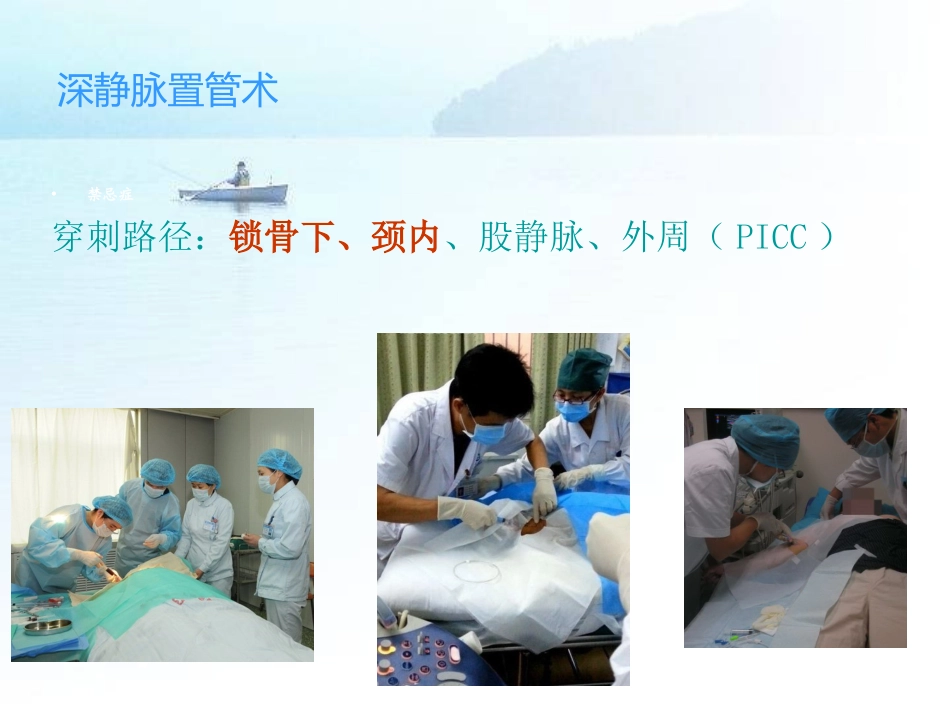 深静脉置管-范松_第2页