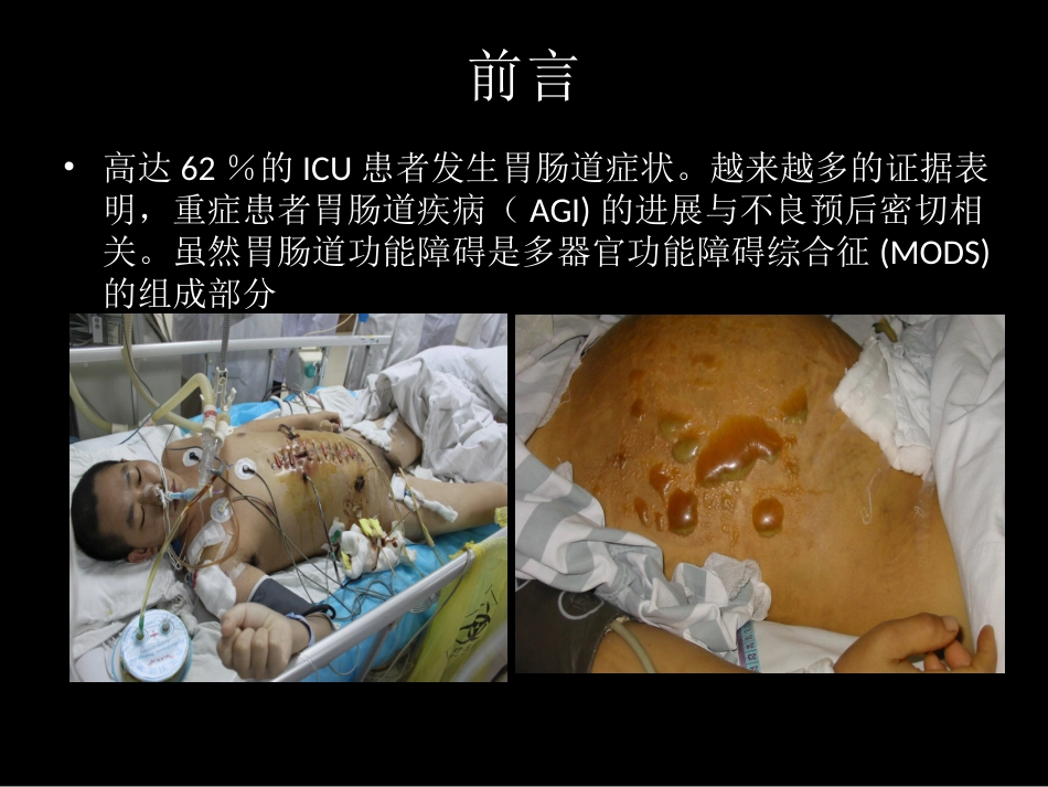 危重病人与营养支持_第3页