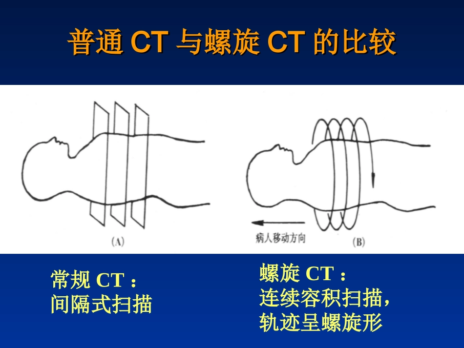 田氏西门子16排螺旋CT后处理技术的骨科应用_第3页