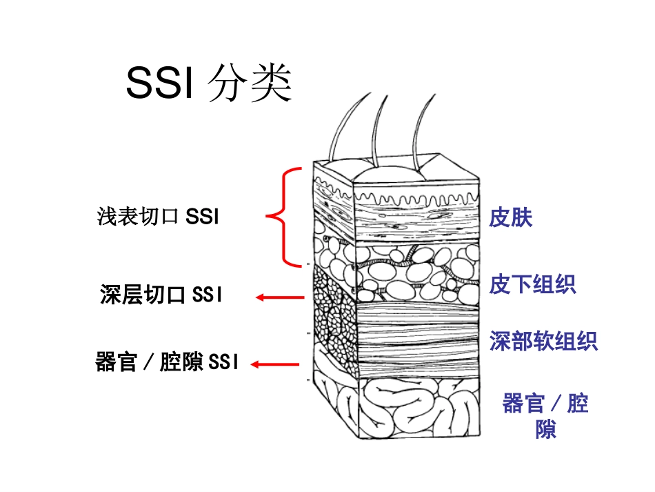 手术部位感染的控_第3页