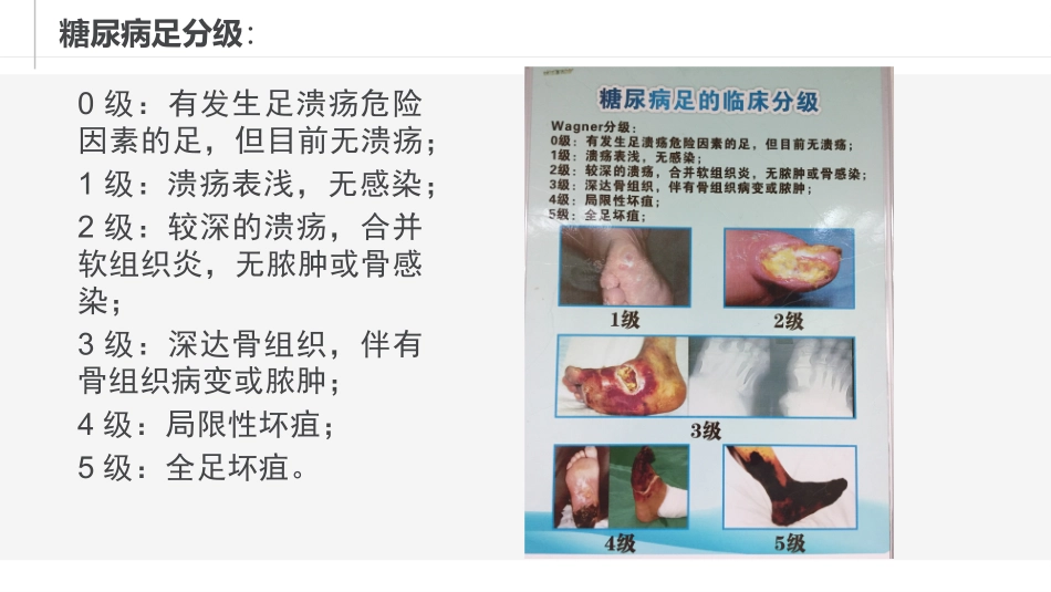 糖尿病足个案_第3页