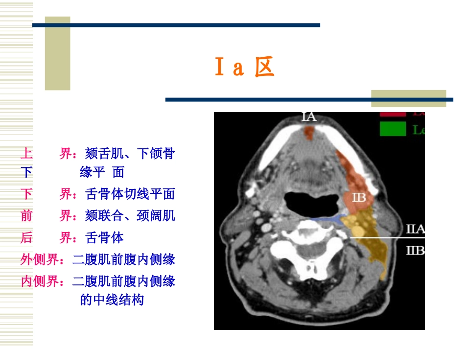 鼻咽癌淋巴引流区定界_第3页