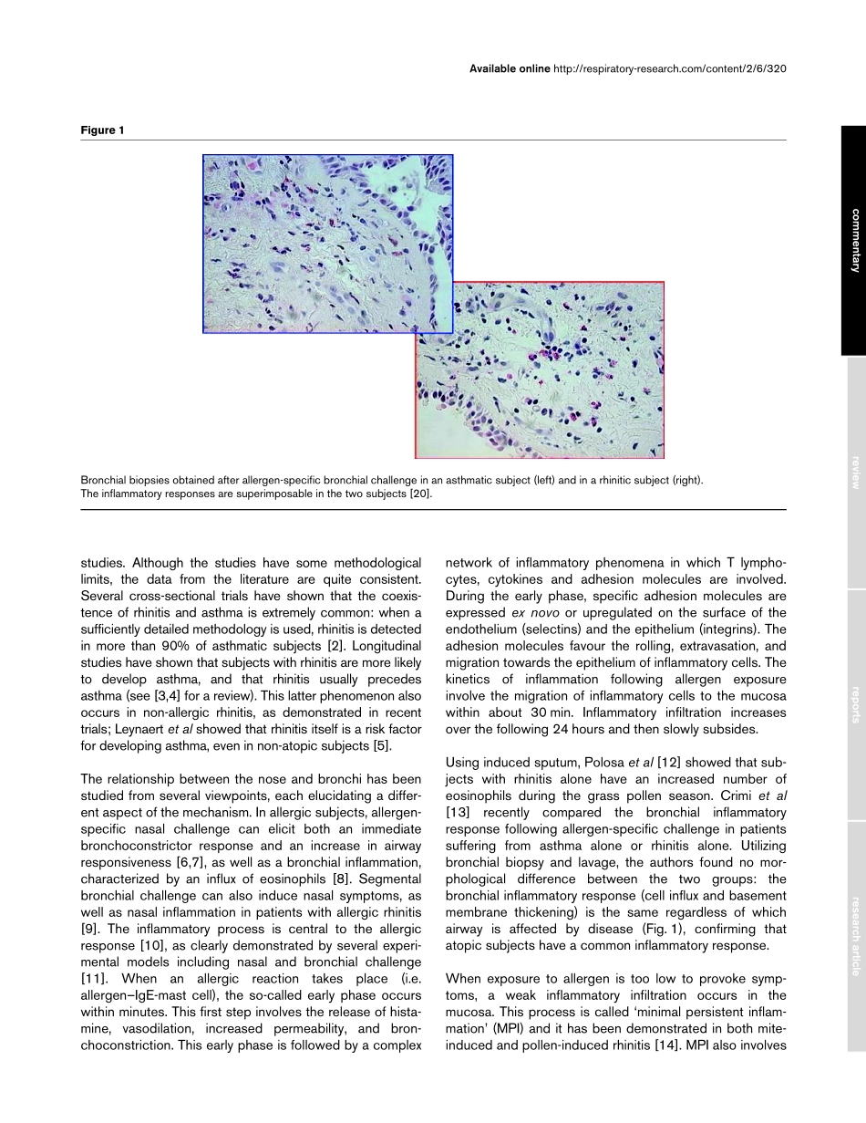鼻窦炎与哮喘_第2页