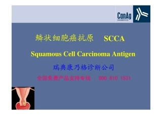 鳞状细胞癌抗原SCCA