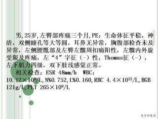髋骨小细胞淋巴瘤