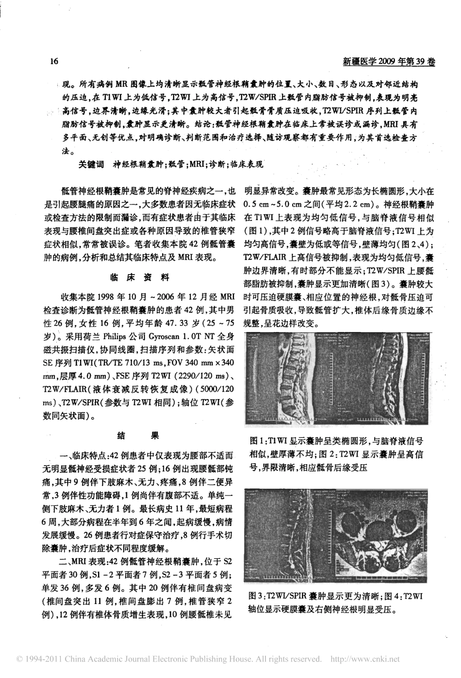 骶管神经根鞘囊肿的MRI诊断价值及临床特点_第2页