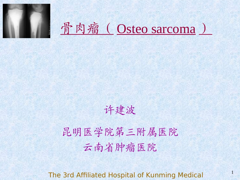 骨肉瘤(Osteosarcoma)-PPT课件_第1页
