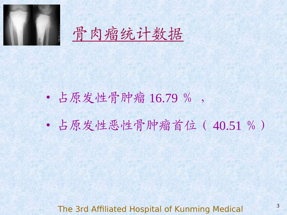 骨肉瘤(Osteosarcoma)-PPT课件_第3页