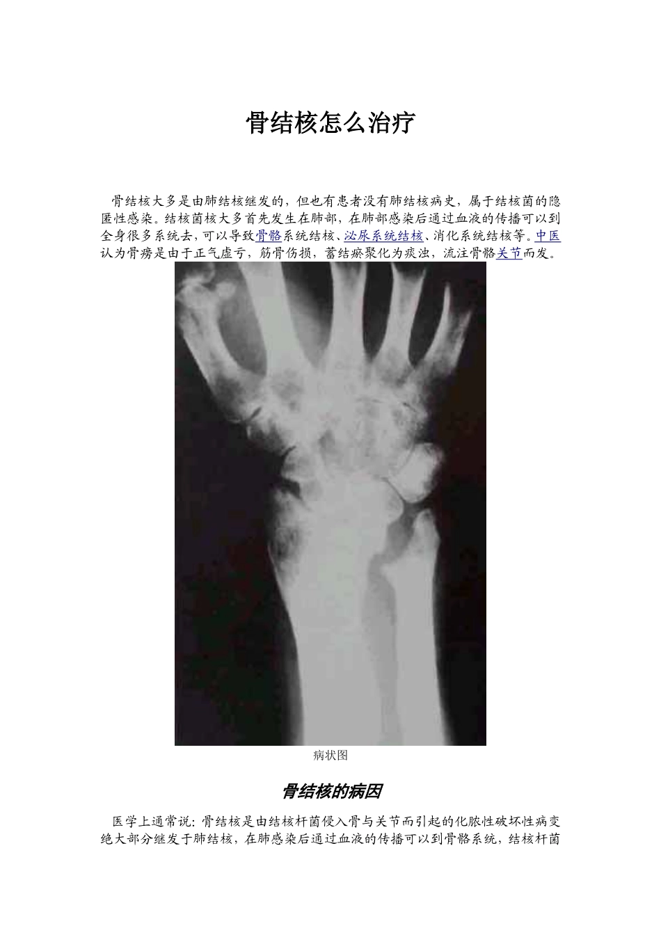 骨结核怎么治疗_第1页