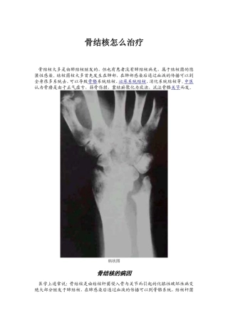 骨结核怎么治疗
