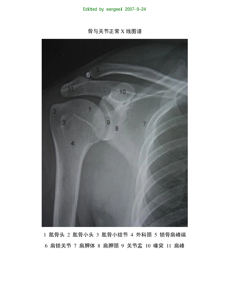 骨与关节正常X线图谱_第1页