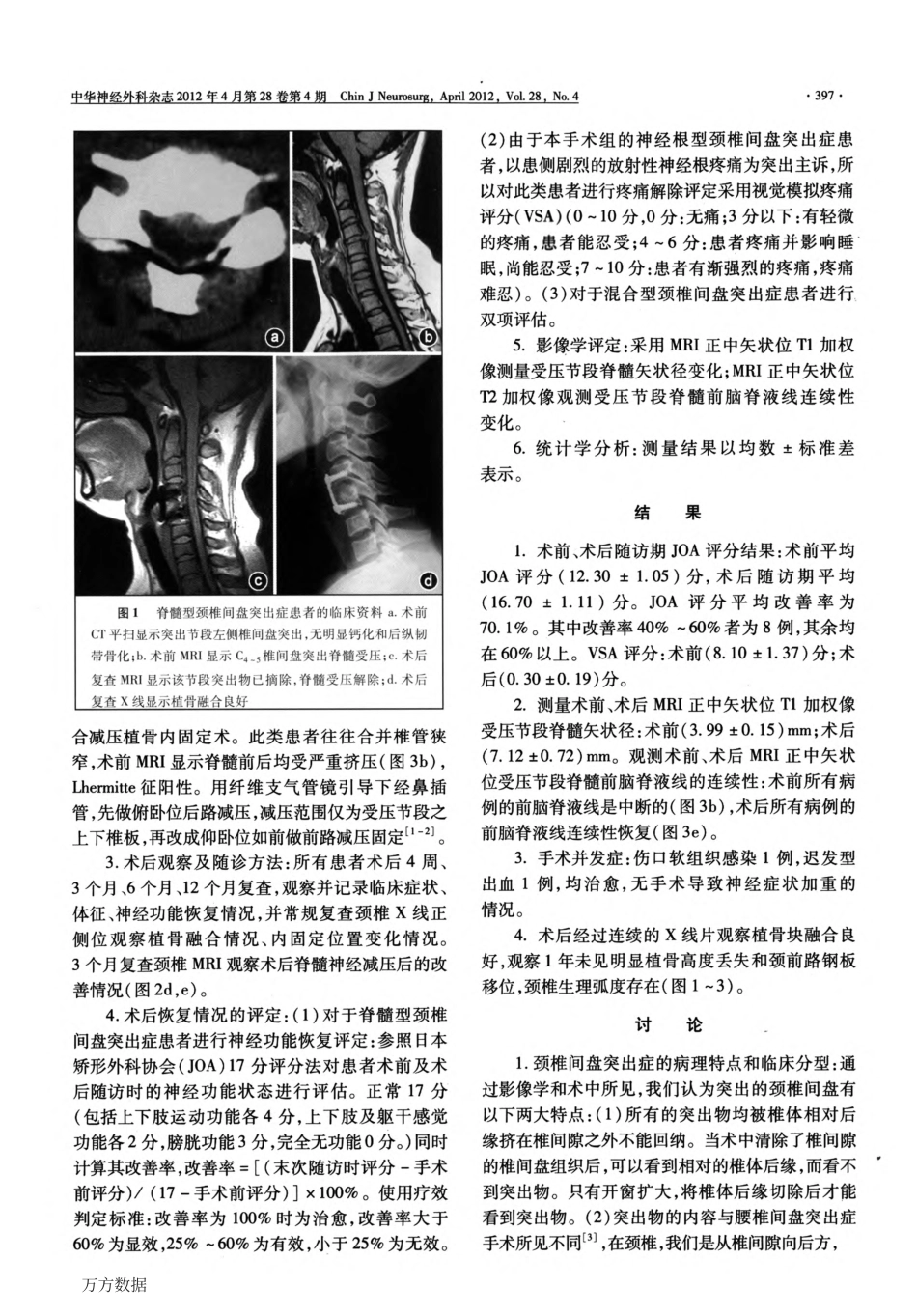 颈椎间盘突出症的手术治疗_第2页