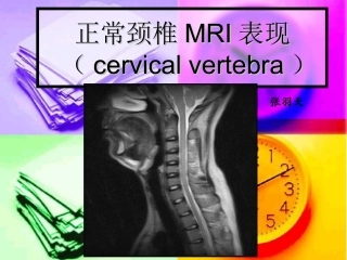 颈椎MRI解剖与常用数据