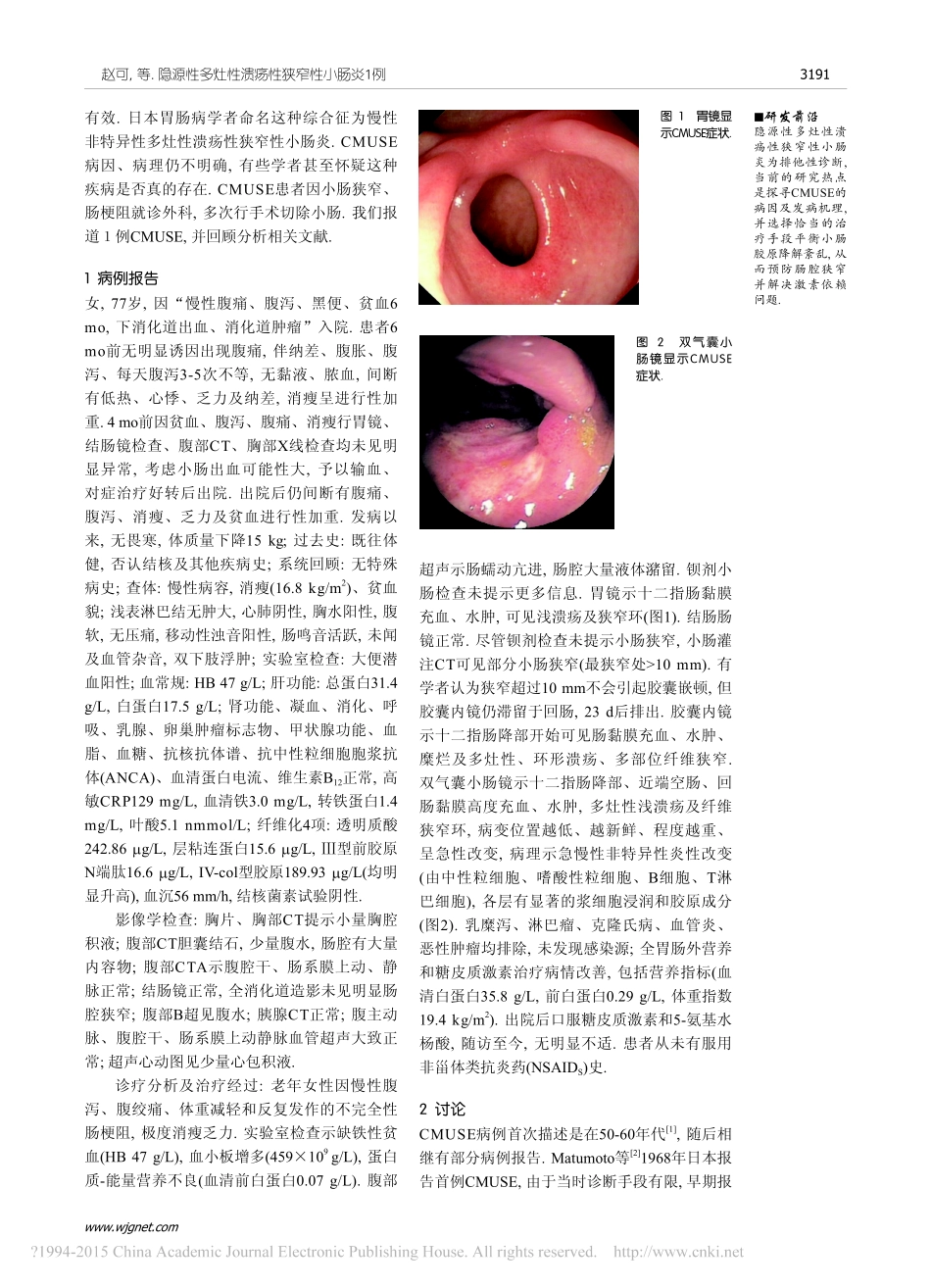 隐源性多灶性溃疡性狭窄性小肠炎1例_赵可_第2页
