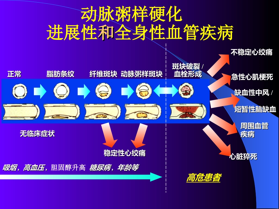 降胆固醇防治冠心病地位与现状_第2页