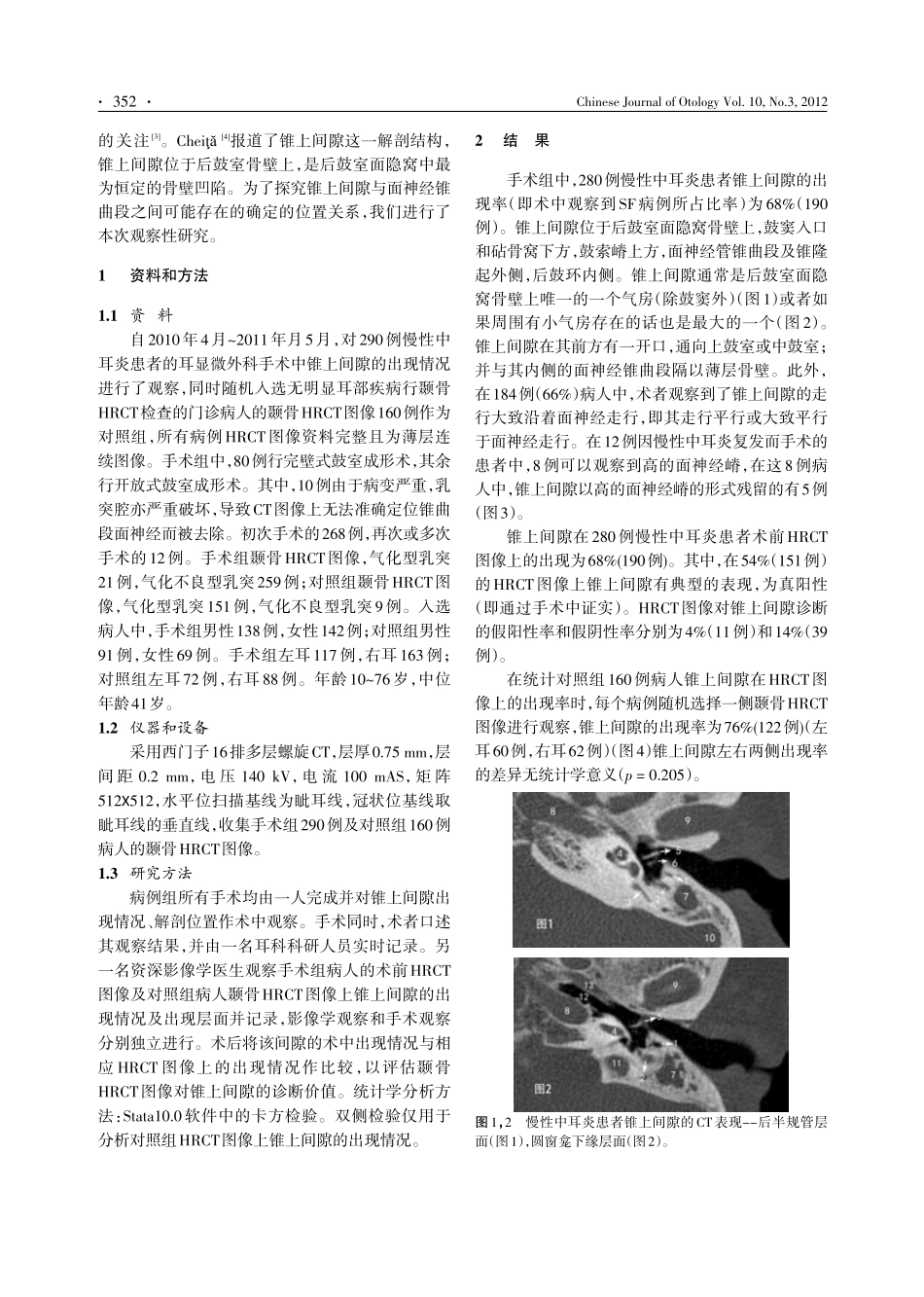 锥上间隙的颞骨HRCT和术中观察 (1)_第2页