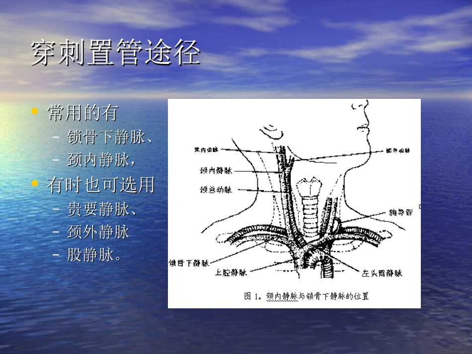 锁骨下静脉穿刺jmcczgjsdlcyy_第3页