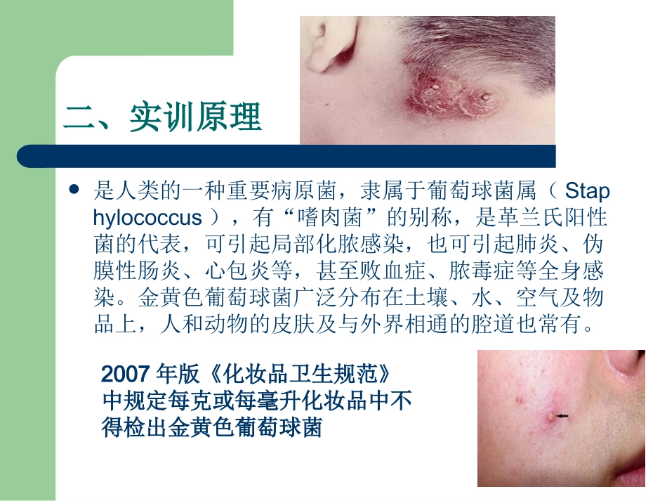 金黄色葡萄球菌的检测_第3页