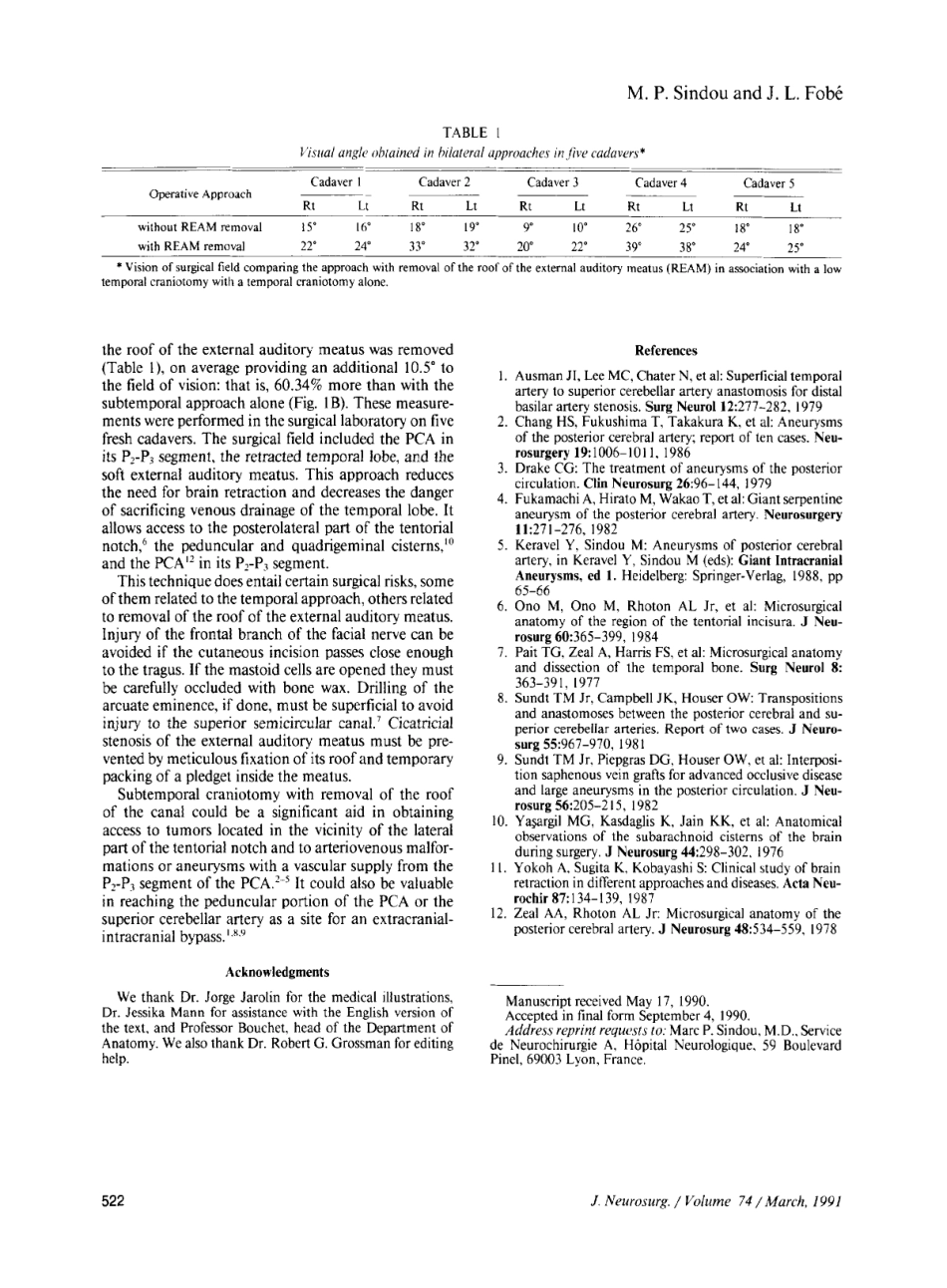 通过外耳道顶切除颞下内肿瘤_第3页