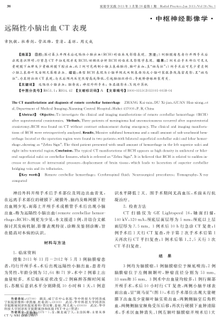 远隔性小脑出血CT表现