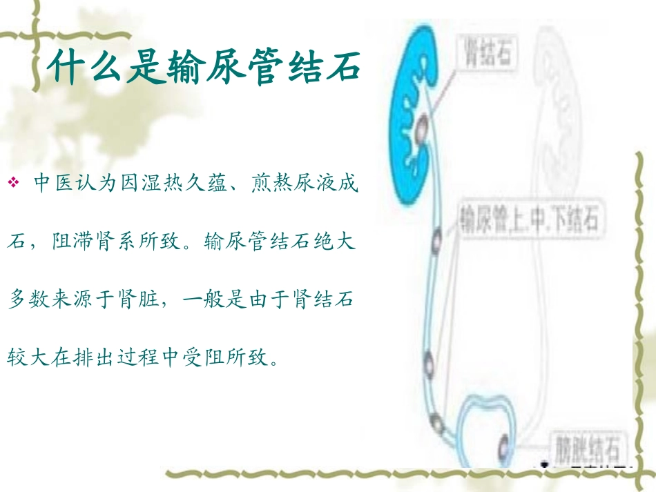 输尿管结石讲课定稿版_第3页