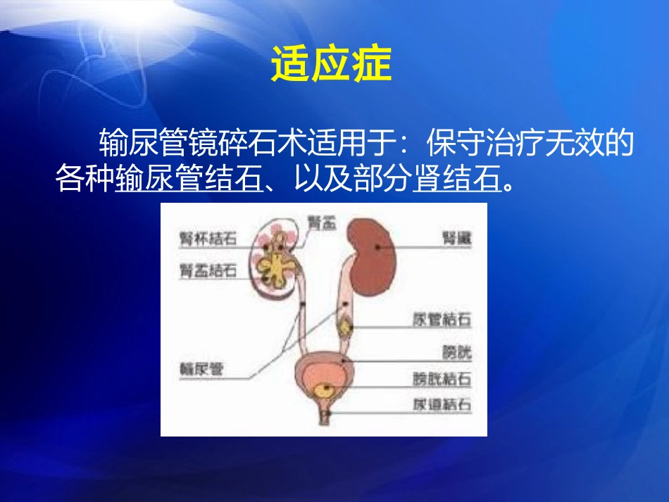输尿管镜碎石术_第3页