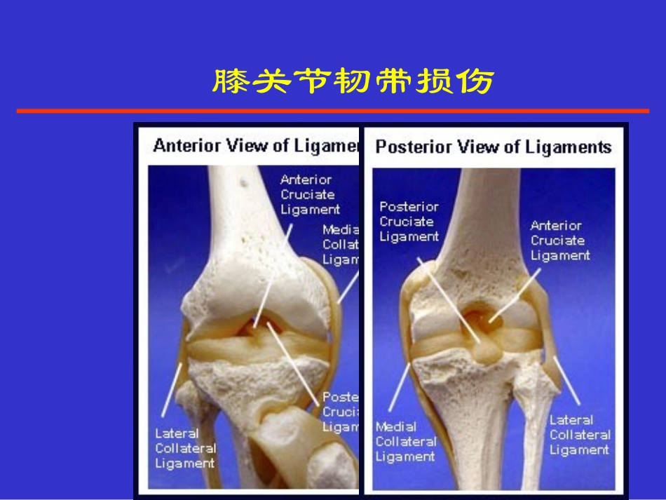 踝关节韧带损伤_第3页