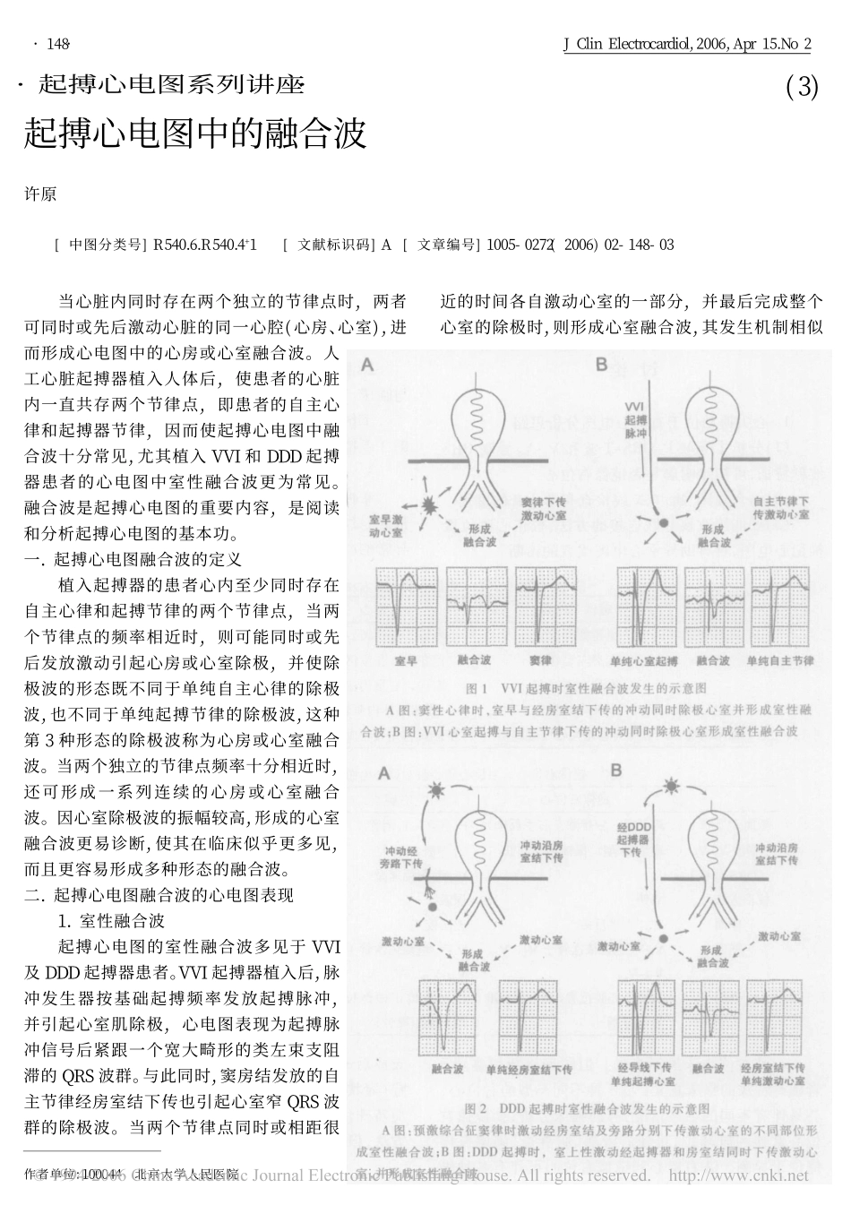 起搏心电图中的融合波_第1页