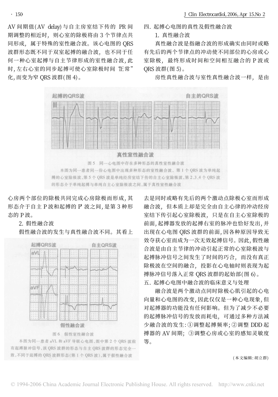 起搏心电图中的融合波_第3页