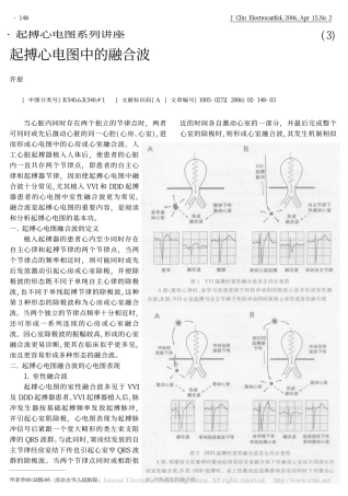 起搏心电图中的融合波