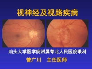 视神经及视路疾病