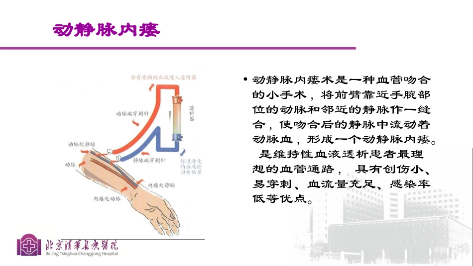 血液透析患者血管通路的自我维护_第3页