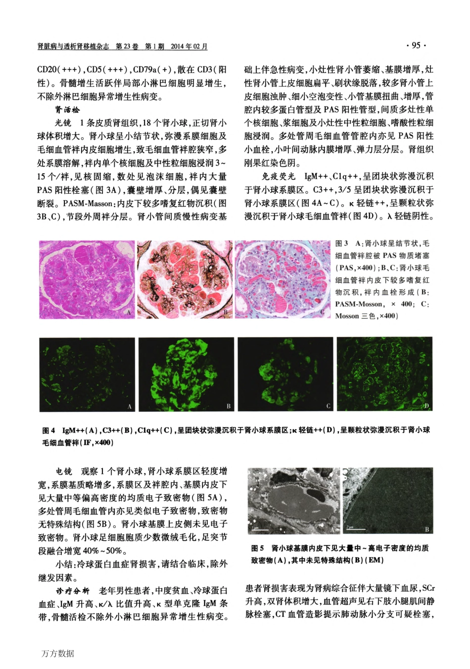 血液净化治疗冷球蛋白血症_第3页
