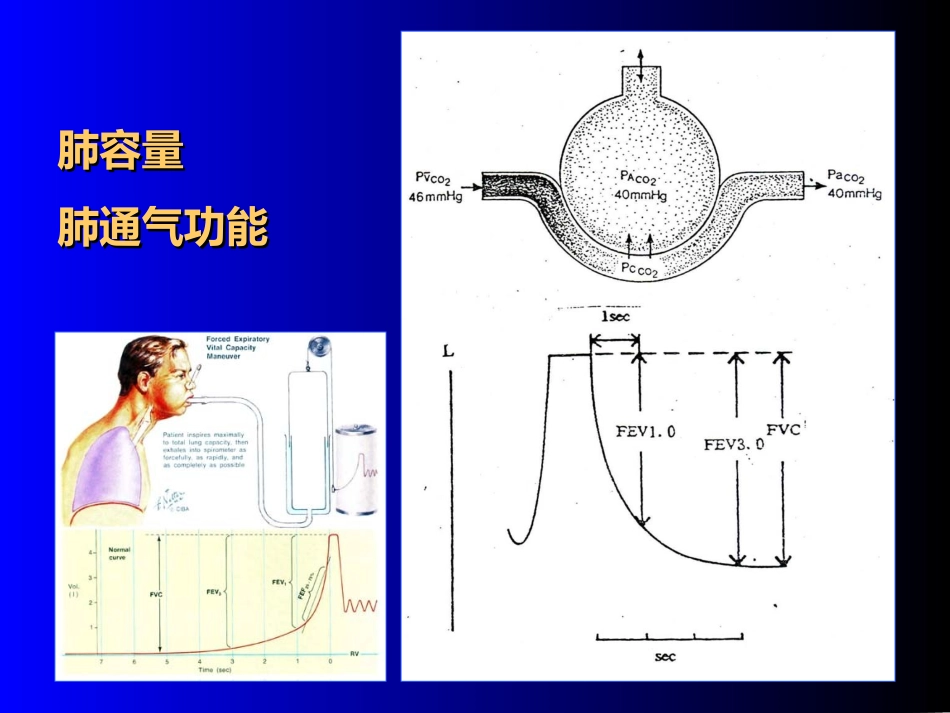 血气分析与呼吸衰竭_第3页