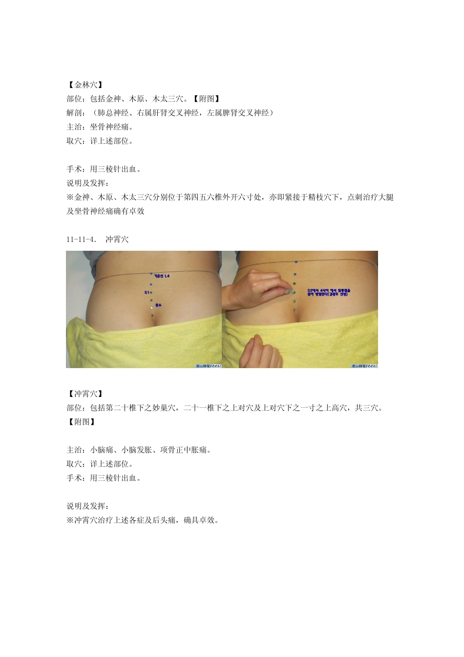 董氏奇穴发挥11_第3页
